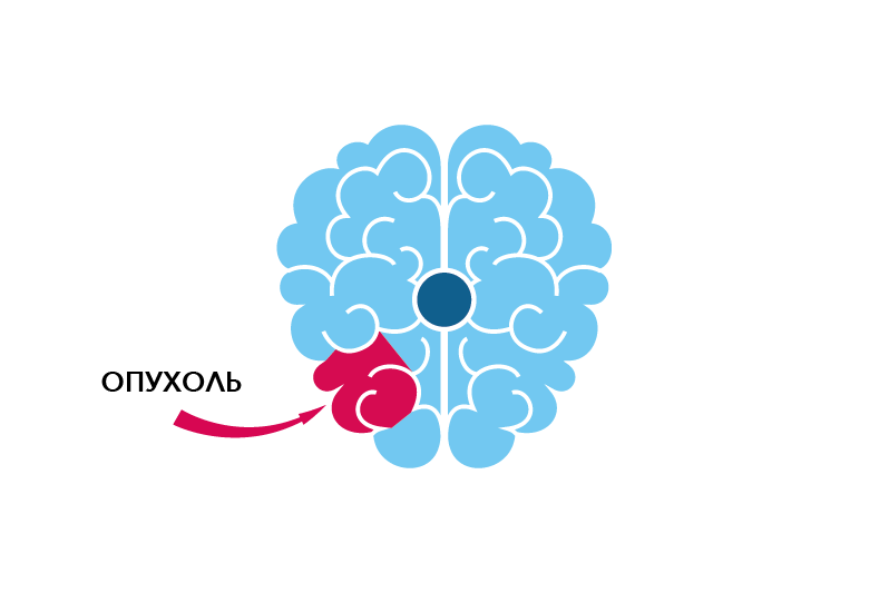 Pikt_6_mozg-01.png