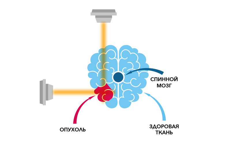 Pikt_6_mozg-02.png