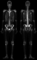 Fig0106(a)(bone scan GE)