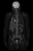 Fig0106(b)(PET image)