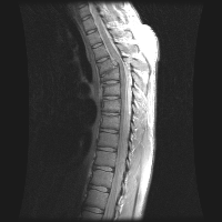 Fig0117(b)(MRI spine1 Vandy)