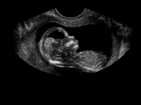 Fig0120(a)(ultrasound fetus1)