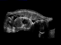 Fig0120(b)(ultrasound fetus2)