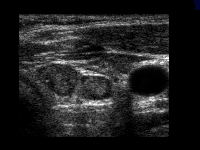 Fig0120(c)(ultrasound tharoid structures)