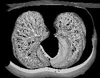 Fig0122(d)(lung)