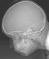 Fig0221(a)(ctskull 256)