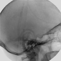 Fig0228(a)(angiography mask image)