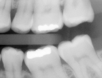 Fig0230(a)(dental xray)