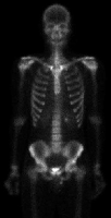 Fig0232(a)(partial body scan)