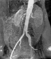 Fig0312(a)(kidney)