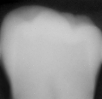 Fig1030(a)(tooth)