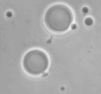 Fig1039(a)(polymersomes)