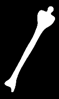 Fig1116(leg bone)