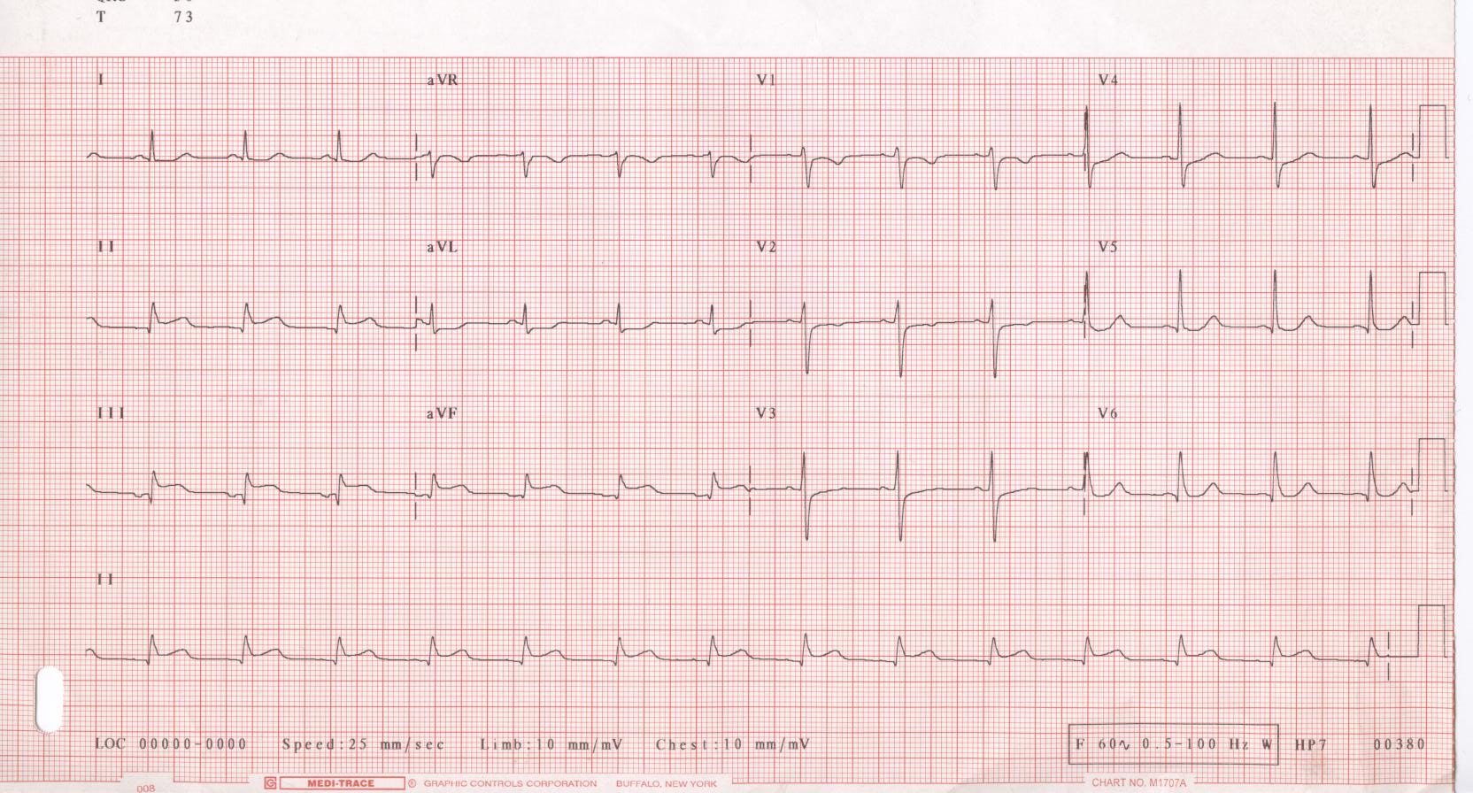 ECG_001.jpg
